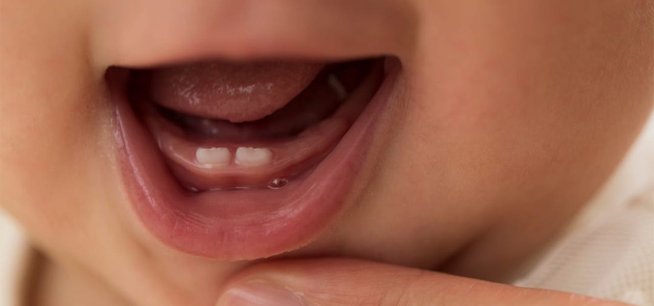 Two baby teeth beginning to grow